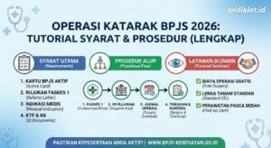 Operasi Katarak BPJS